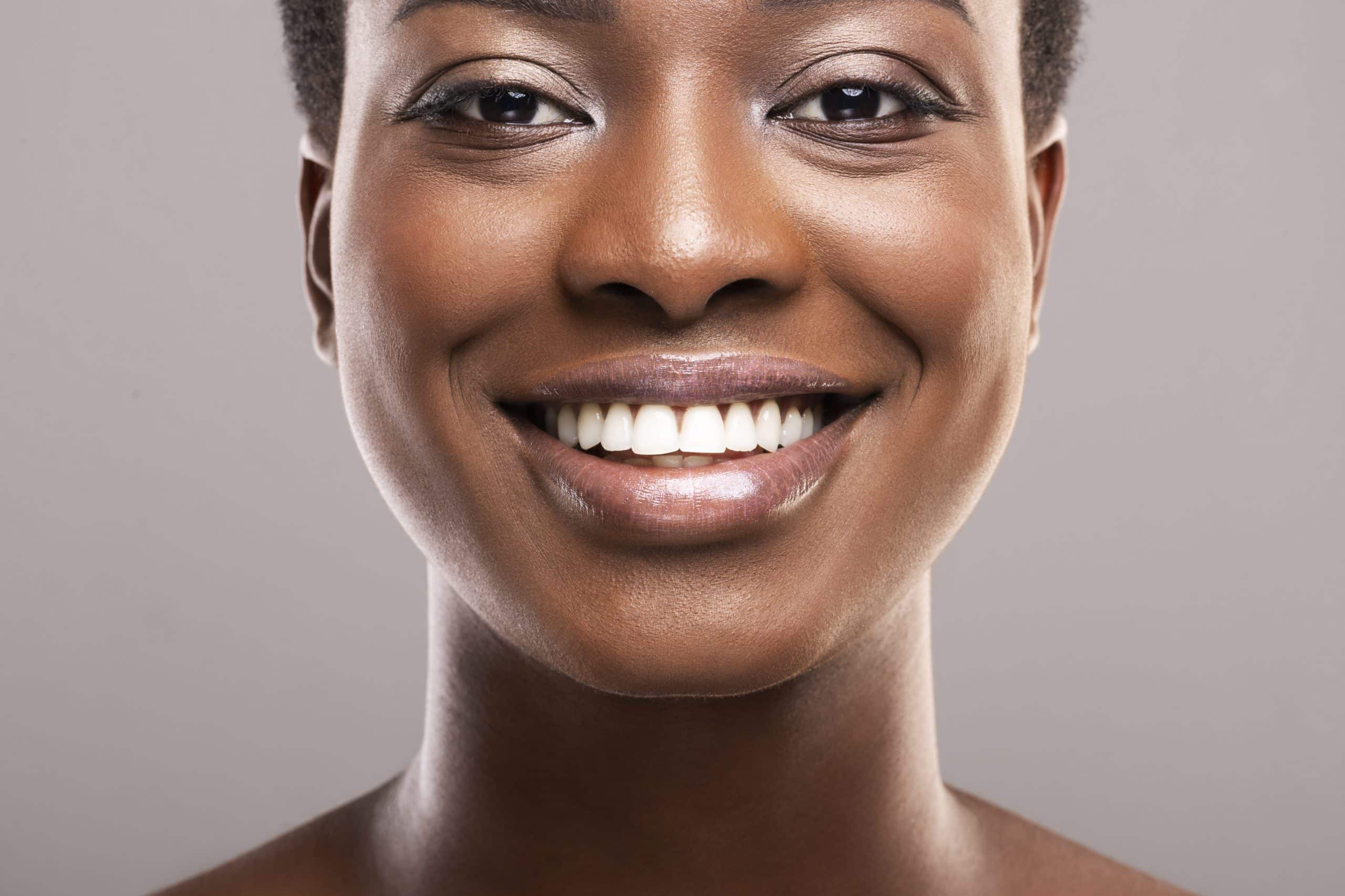 Como fazer para clarear os dentes? Confira 2 dicas simples de como fazer em casa 1 Clarear os dentes