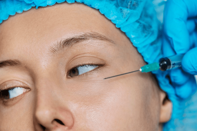 Botox e Ácido Hialurônico: veja quais são as diferenças de cada procedimento 2 botox e ácido hialurônico