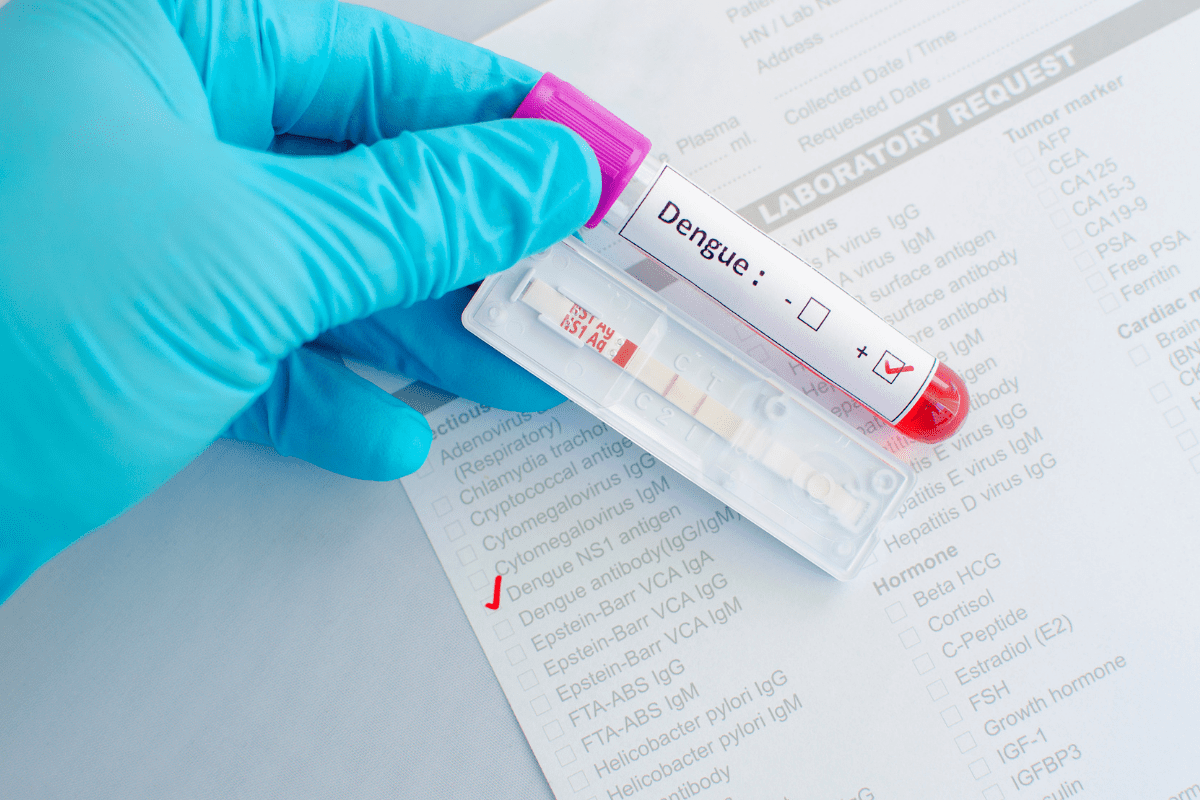 Como aliviar os sintomas da dengue? Aprenda com medidas práticas e simples 2 Como aliviar os sintomas da dengue