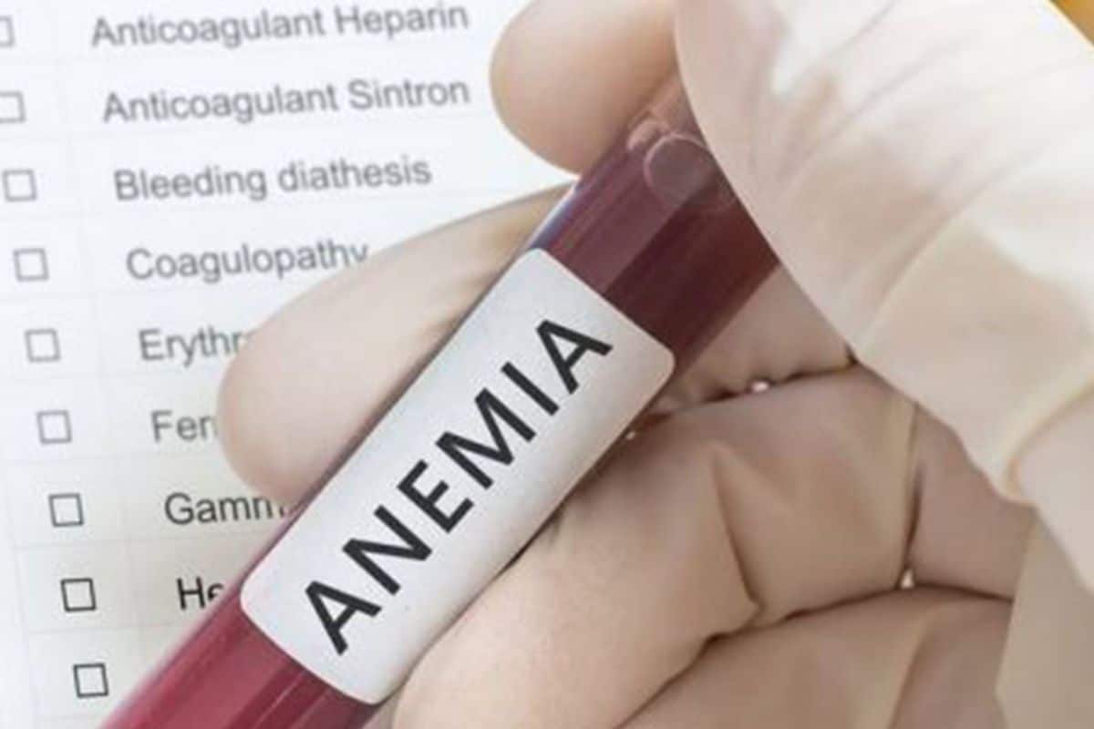 Qual exame detecta a anemia? Entenda mais dessa doença e como diagnosticar 1 Descubra o que causa anemia