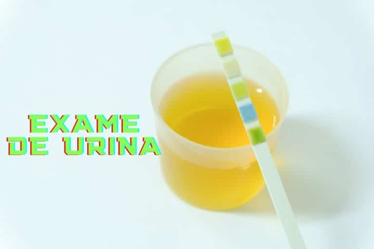 Por que exame de urina tem que ser o primeiro jato da manhã? 1 exame de urina Canva