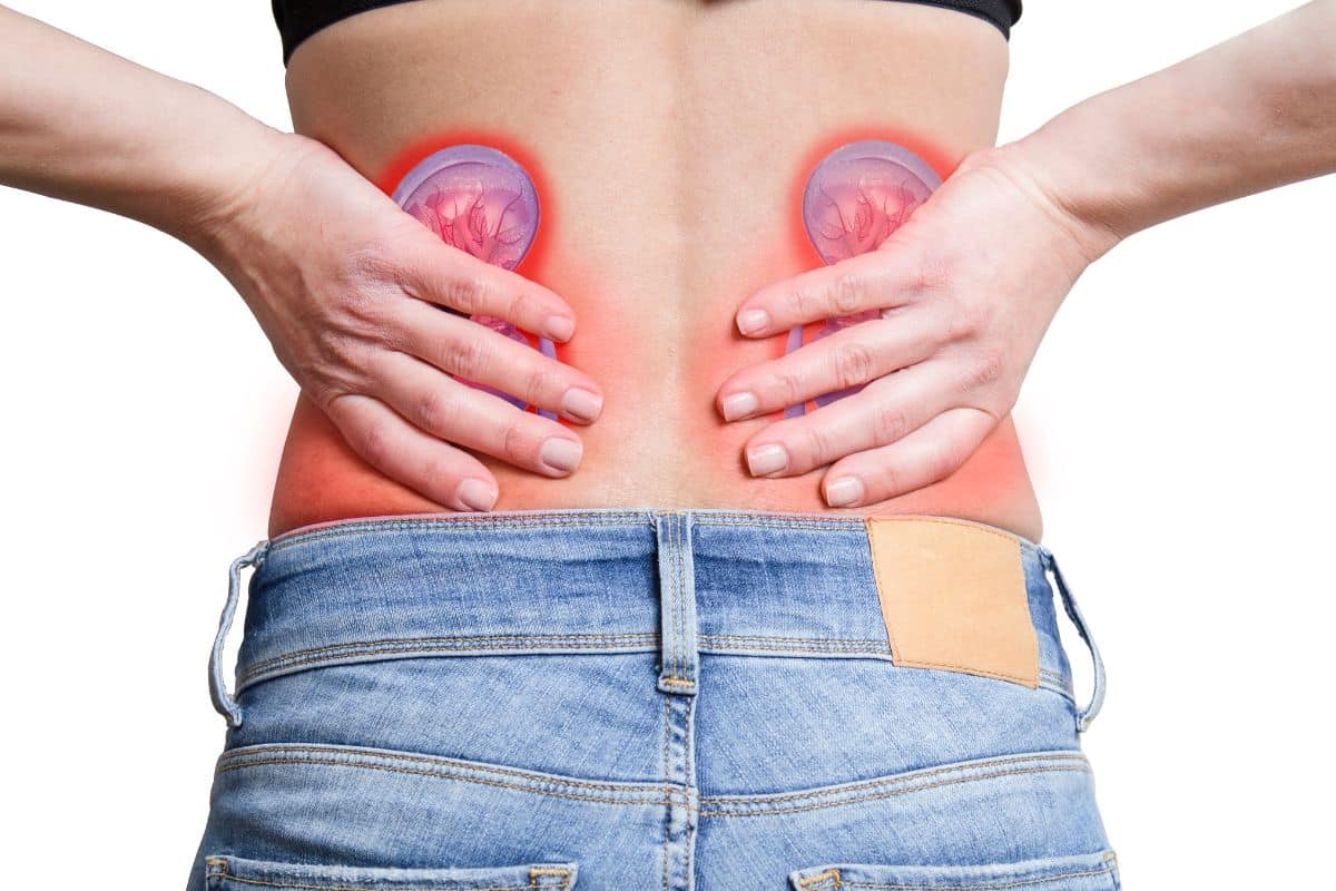 Pedra no rim: o que causa e onde dói o cálculo renal? Veja como prevenir 2 mulher com mãos na cintura onde dói pedra no rim