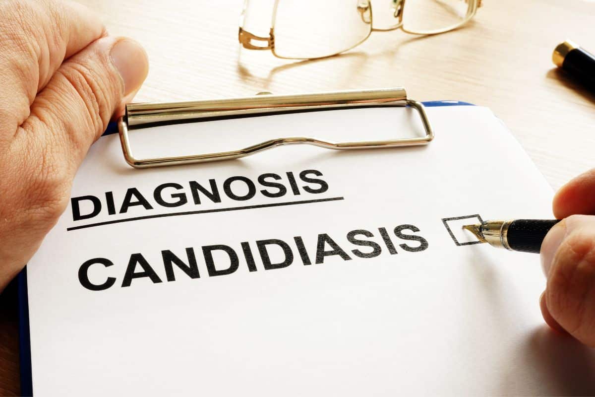 O que causa candidíase? Retire todas suas dúvidas e aprenda como se cuidar 2 diagnóstico e o que cândida