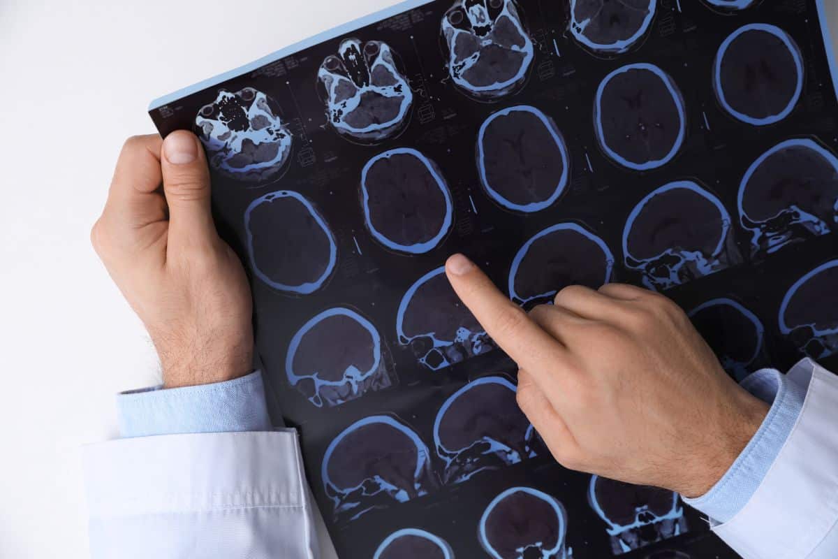 Você sabe a diferença entre tomografia e ressonância magnética? Descubra agora 1 médico avaliando tomografia