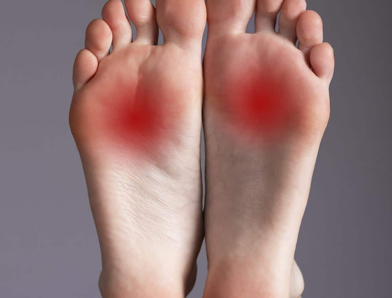 Neuroma de Morton: sapatos apertados ou com bico fino podem causar tumores nos pés 1 neuroma de morton