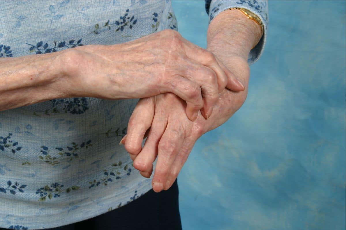 Quais são os sintomas de reumatismo? Entenda o problema e como tratar 1 sintomas de reumatismo nas mãos