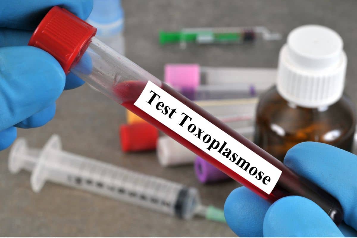 Quais são os principais sintomas da toxoplasmose? Tem tratamento? 1 toxoplasmose