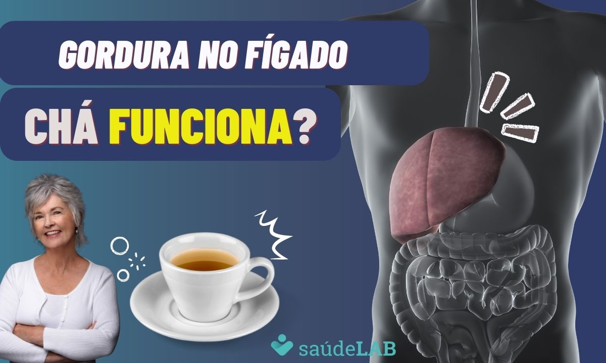 Gordura no fígado: conheça 5 CHÁS que ajudam a resolver o problema 1 Chá para gordura no fígado.