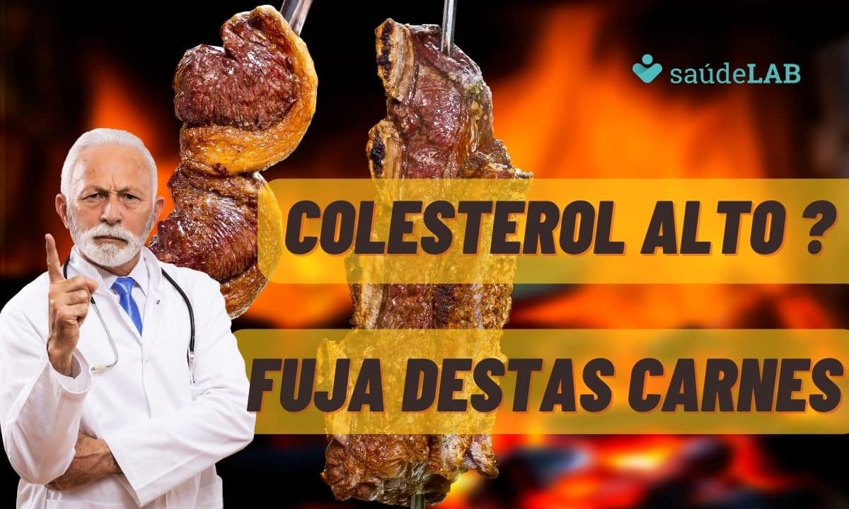 Colesterol alto? Veja quais os cortes de carne que devem ser evitados 1 Colesterol alto? Veja quais os cortes de carne que devem ser evitados