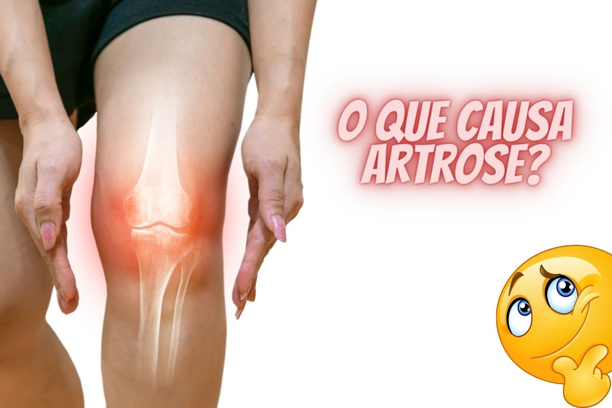 O que é artrose e quais as causas? Tem tratamento? Descubra agora 1 causas de artrose no joelho
