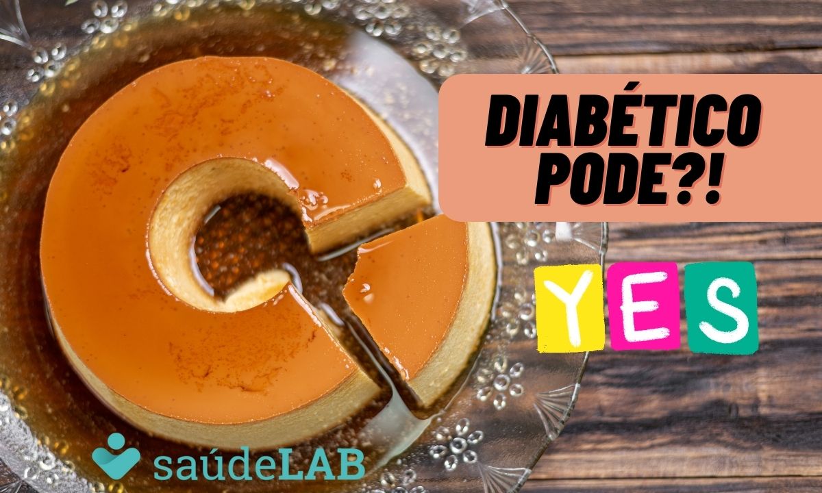 Pudim para diabéticos: que tal provar essa sobremesa hoje? 1 Pudim para diabéticos