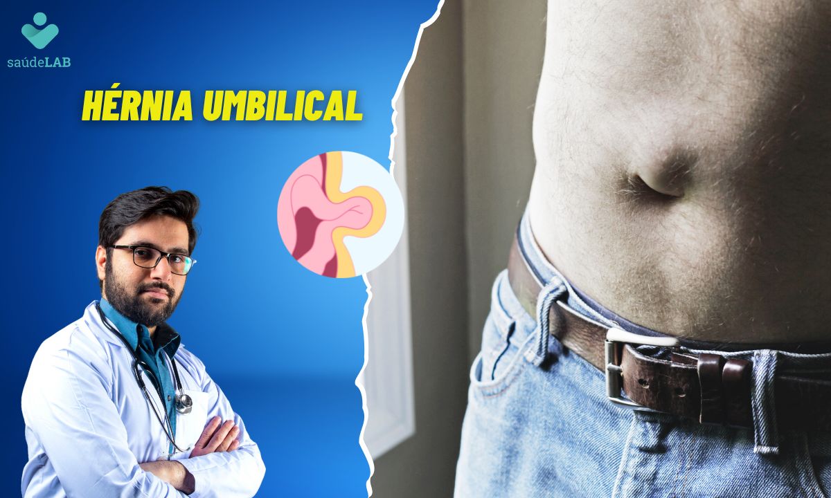 Hérnia Umbilical: quais são as causas? Tem como prevenir? Saiba mais 1 Hérnia Umbilical.