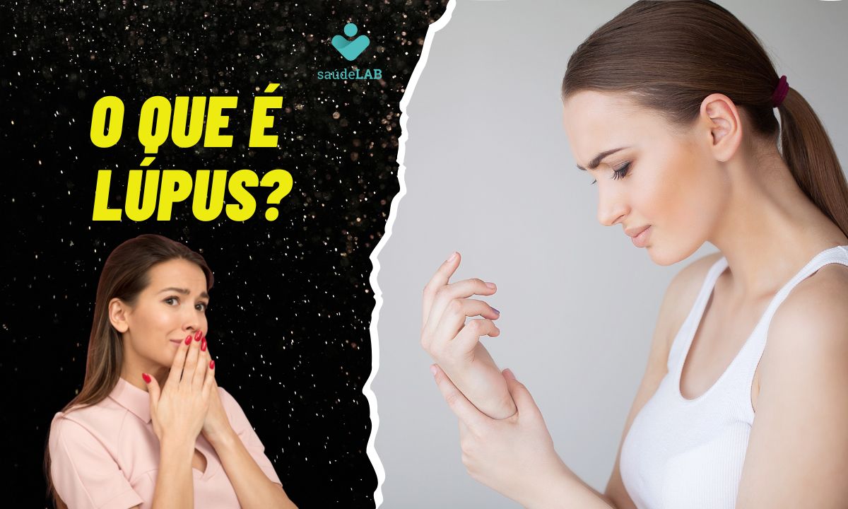 O que é Lúpus? Conheça os tipos, sintomas e como ele afeta a saúde 1 O que é lúpus?