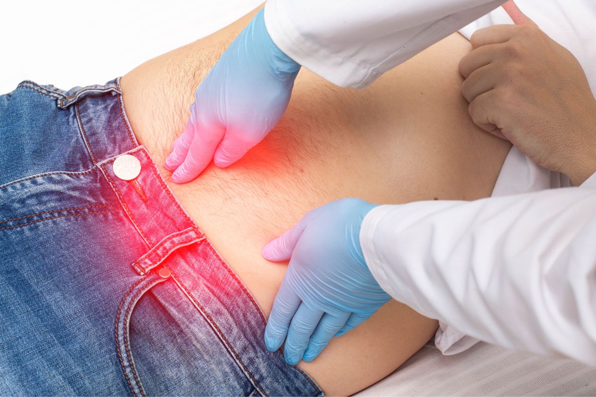 Hérnia Umbilical: quais são as causas? Tem como prevenir? Saiba mais 2 Quais são as causas da hérnia umbilical