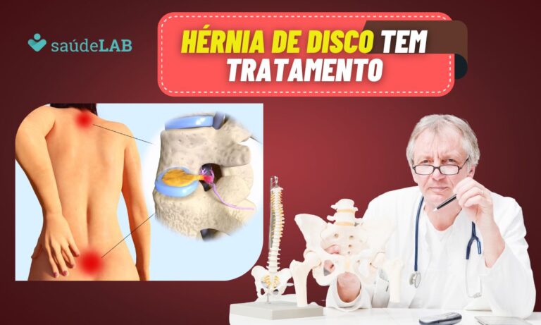 Entenda as causas hérnia de disco? Por que dói? Como é feito o tratamento? Tem como prevenir? 1 Hérnia de Disco.