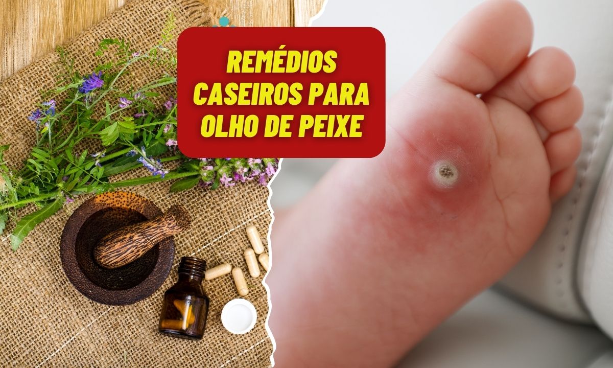 Remédio caseiro para olho de peixe: aprenda 05 dicas para aliviar o desconforto 1 Remédio Caseiro para olho de peixe.