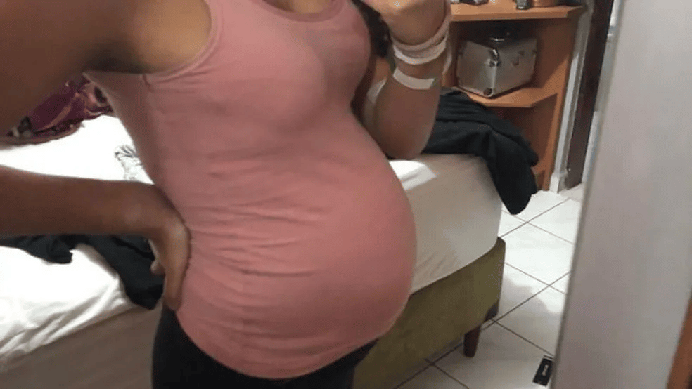 Aparentando estar grávida, jovem de 18 anos é diagnosticada com cisto de ovário de 7kg 1 Jovem de 18 anos é diagnosticada com cisto de ovário de 7kg