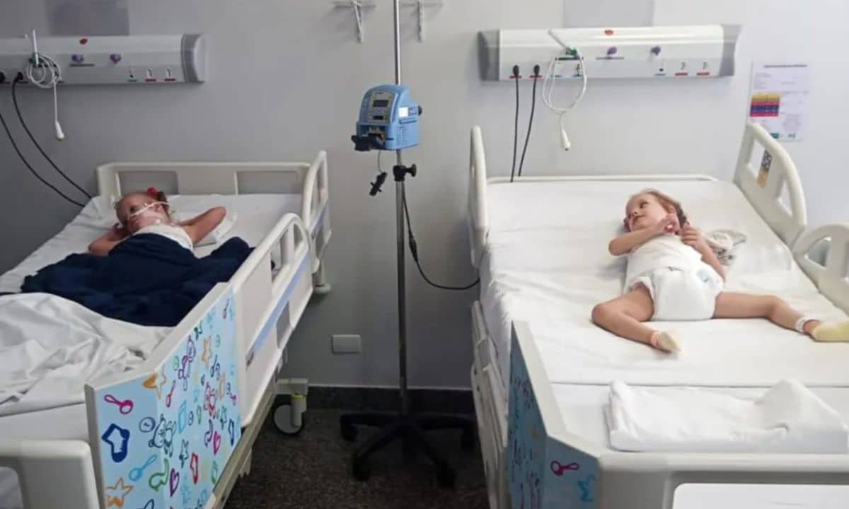 Gêmeas Siamesas separadas em Goiânia recebem alta após 51 dias da cirurgia 3 Gêmeas Siamesas.
