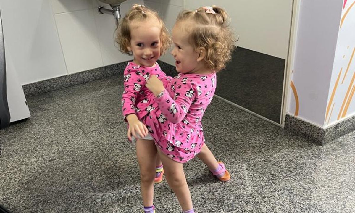 Gêmeas Siamesas separadas em Goiânia recebem alta após 51 dias da cirurgia 1 Gêmeas Siamesas.