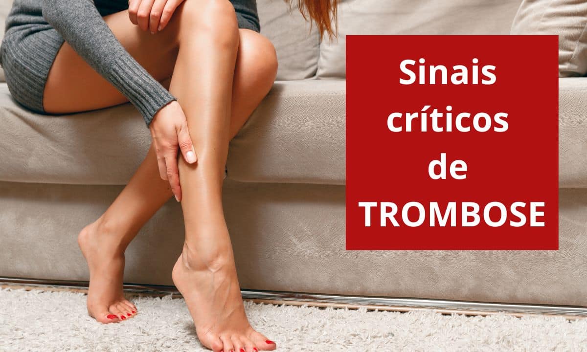 Sintomas de trombose: conheça 5 sinais que quase ninguém percebe 1 Sintomas de trombose.