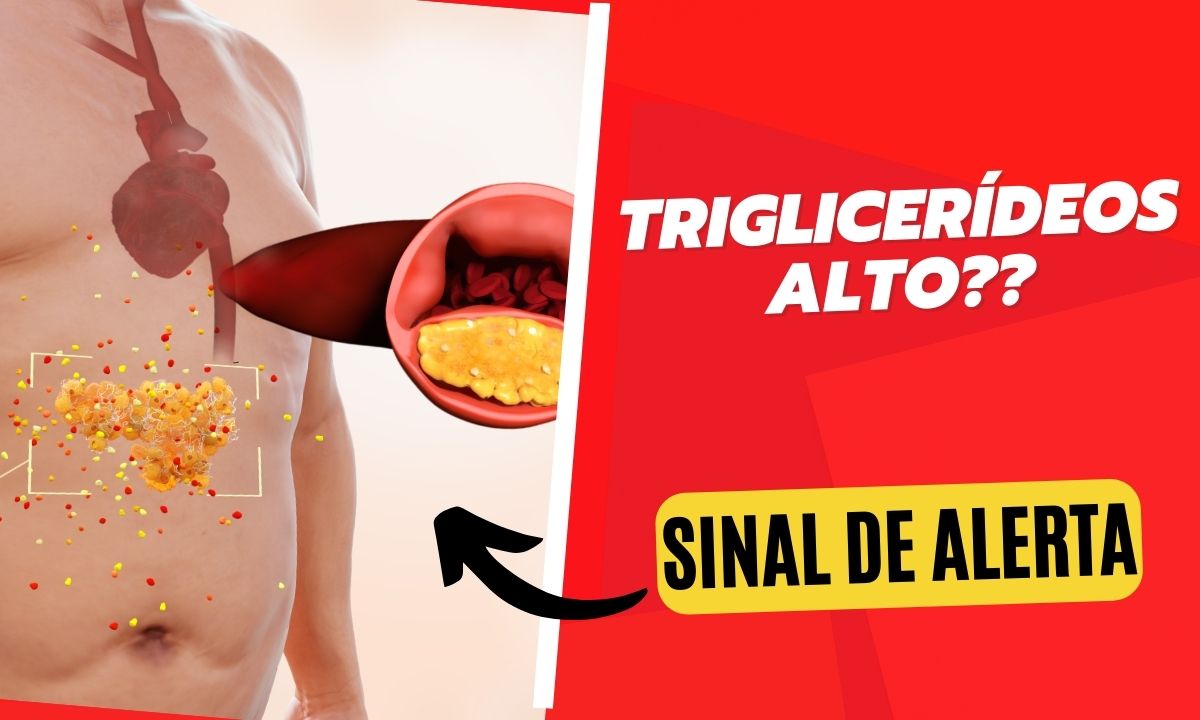 Triglicerídeos Alto? Descubra o que causa e como controlar corretamente 1 Triglicerídeos Alto.