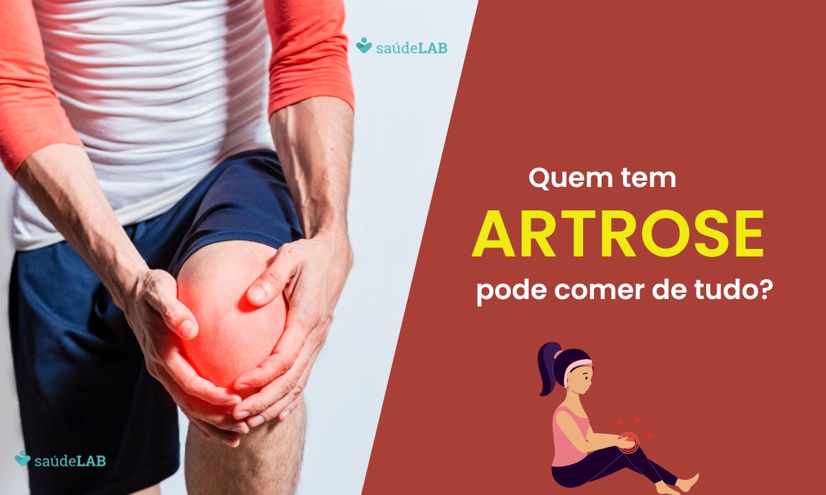 Quem tem artrose precisa comer o quê? Conheça os alimentos que você deve ou não consumir 1 Alimentação para artrose.