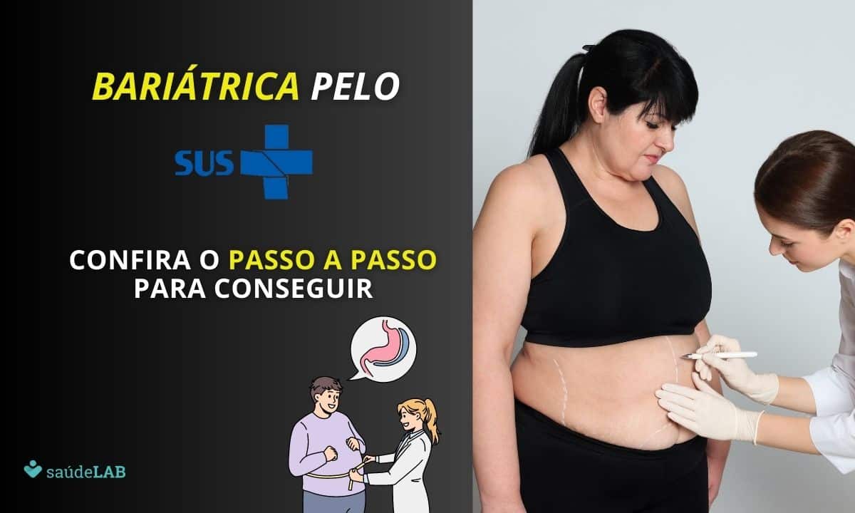 Como conseguir bariátrica pelo SUS? Descubra o passo a passo necessário 1 Como conseguir cirurgia bariátrica pelo SUS.