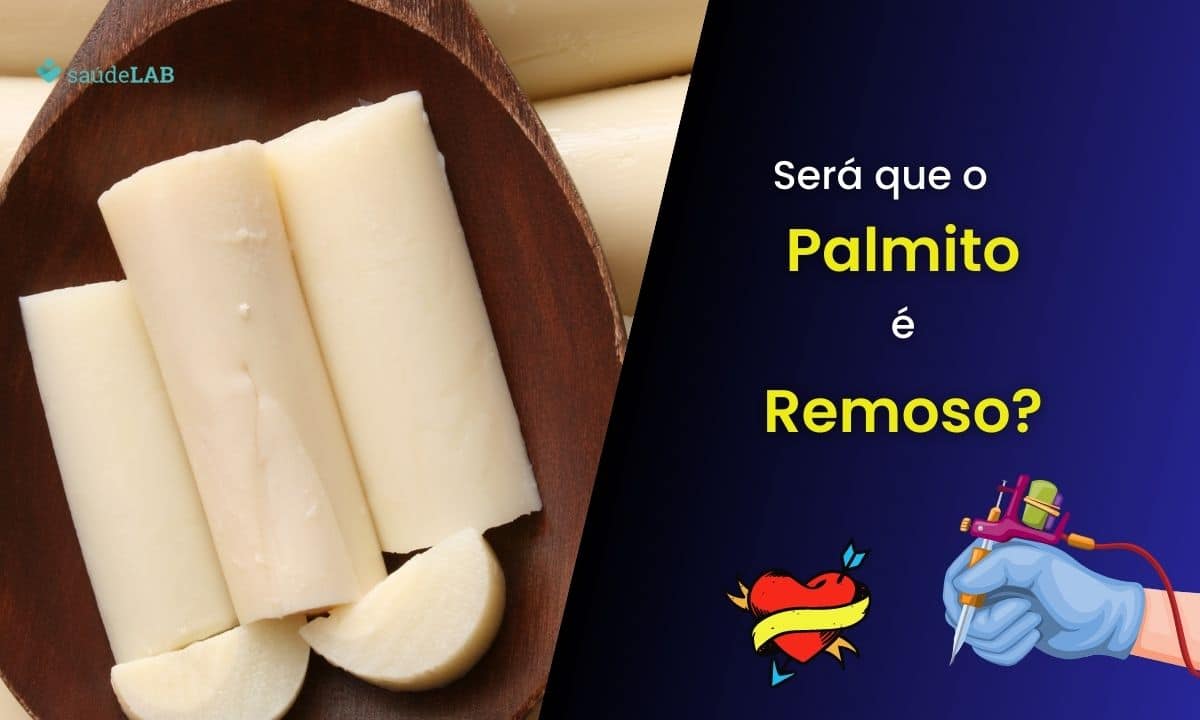 Palmito é remoso? Entenda de que forma ele pode afetar seu organismo 1 Palmito é remoso.