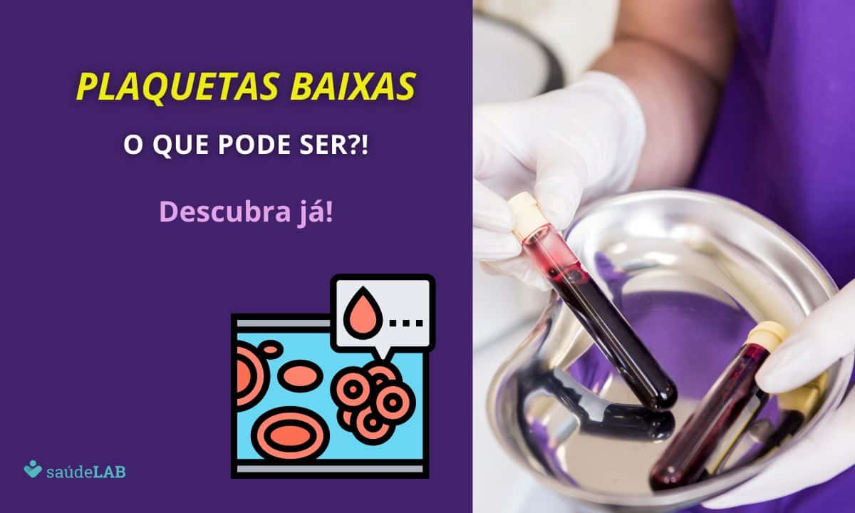 Plaqueta baixa: o que pode ser? Entenda aqui as 13 causas mais comuns para aceder o alerta 1 Plaquetas baixas o que pode ser?