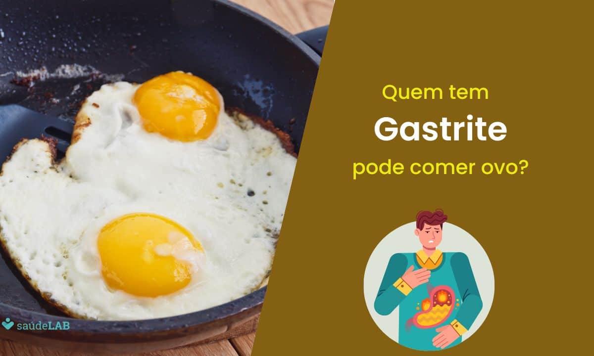 Quem tem gastrite pode comer ovo ou não? Entenda os riscos 1 Quem tem gastrite pode comer ovo.
