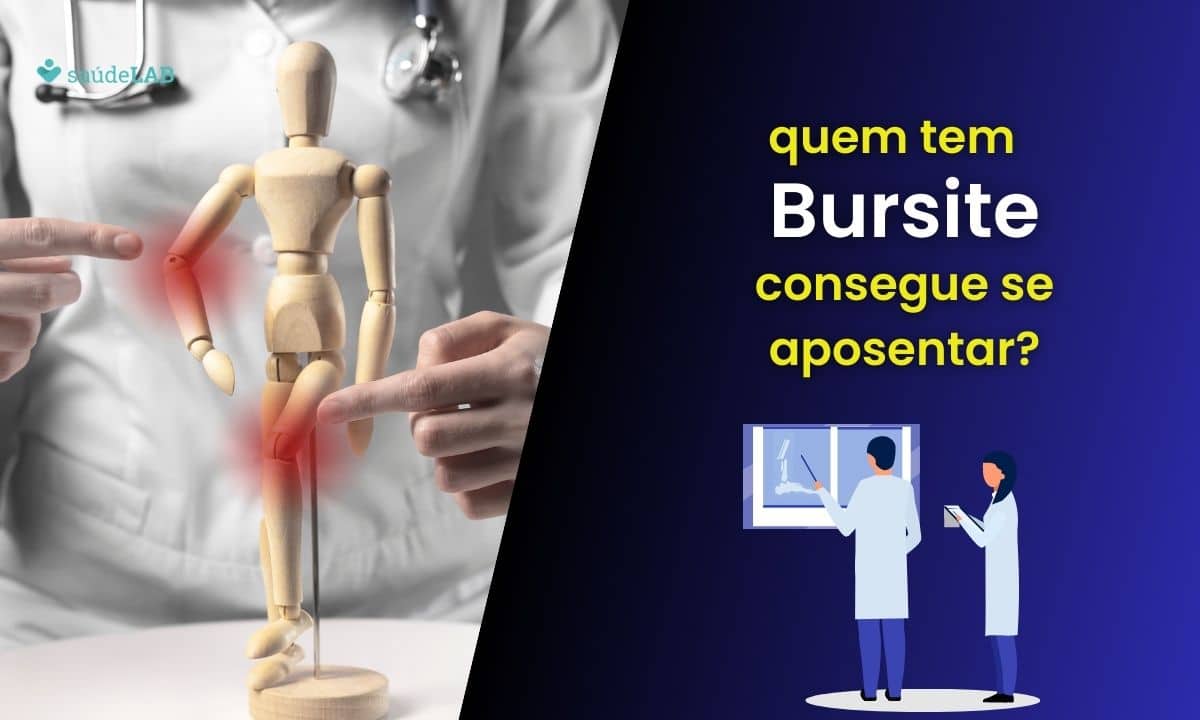 Bursite aposenta? Saiba como funciona aposentadoria por invalidez 1 Bursite aposenta.