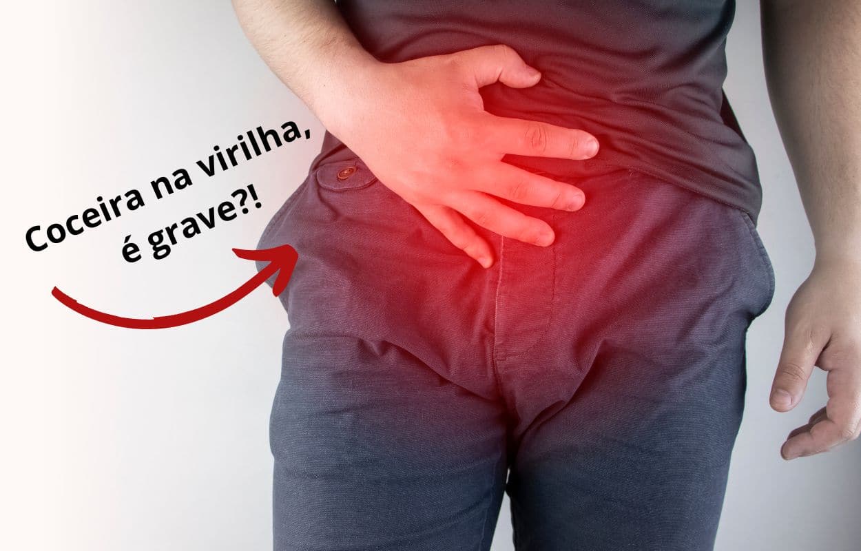 Coceira na virilha: o que pode ser? Confira 10 doenças que causam esse sintoma 1 Coceira na virilha, o que pode ser?