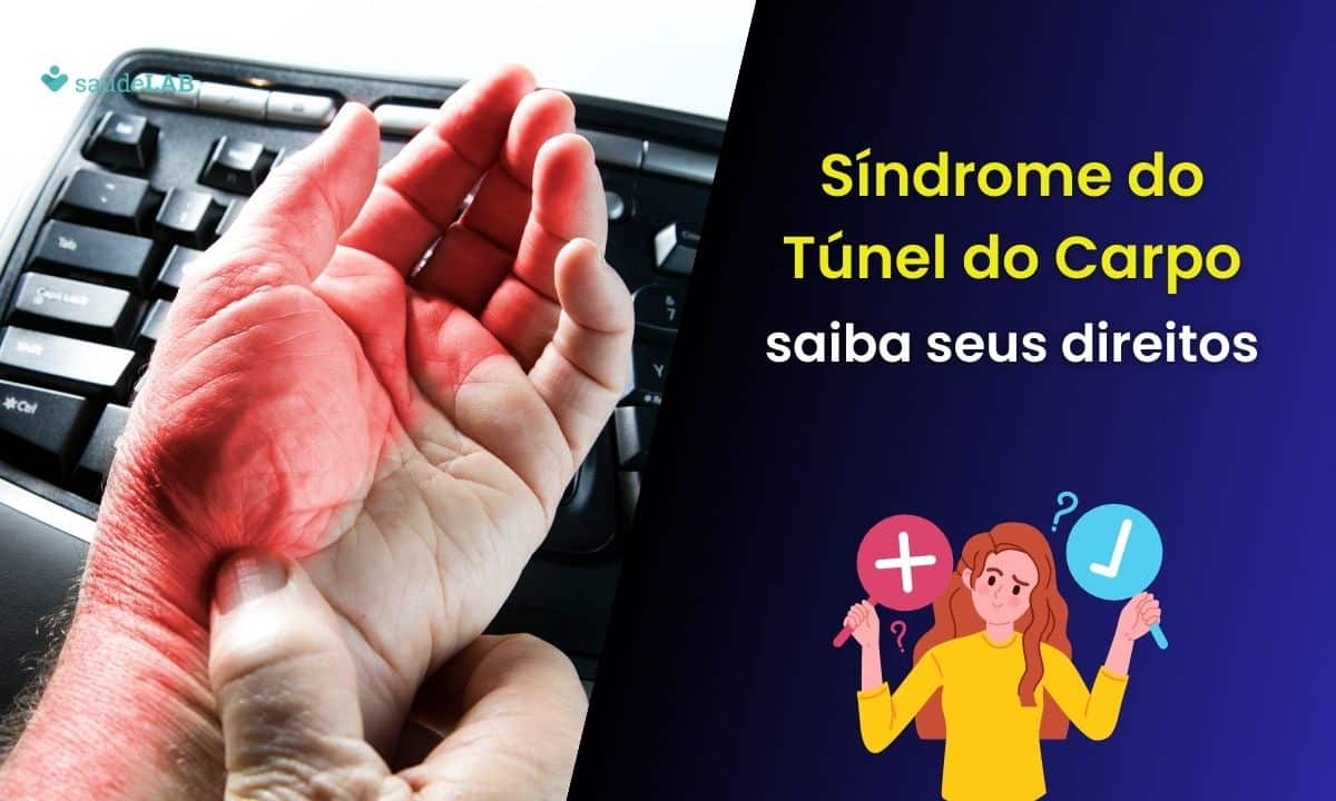 Quais os direitos de quem tem Síndrome do Túnel do Carpo? Descubra! 1 Direitos de quem tem síndrome do túnel do carpo.