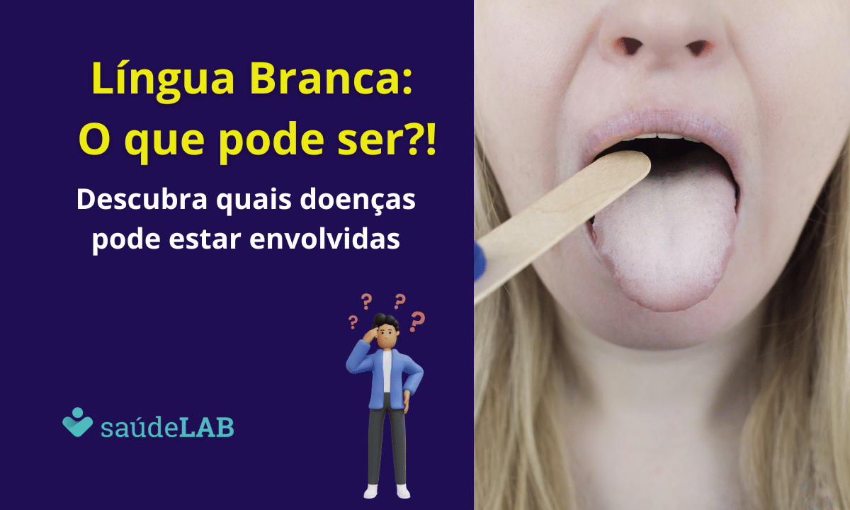 Língua branca: o que pode ser?! Confira 7 causas comuns para acender o alerta 1 Língua Branca: o que pode ser?!