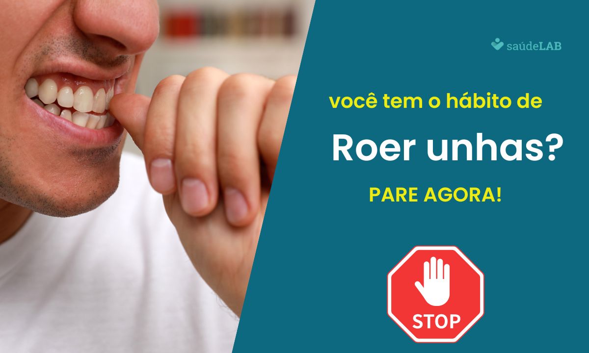 Roer unha faz mal? Saiba como esse hábito afeta sua saúde 1 Roer unhas faz mal.
