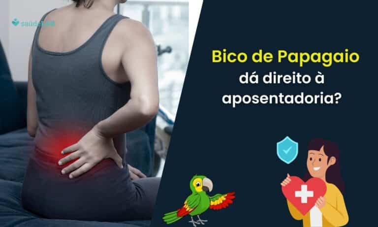 Bico de papagaio aposenta.