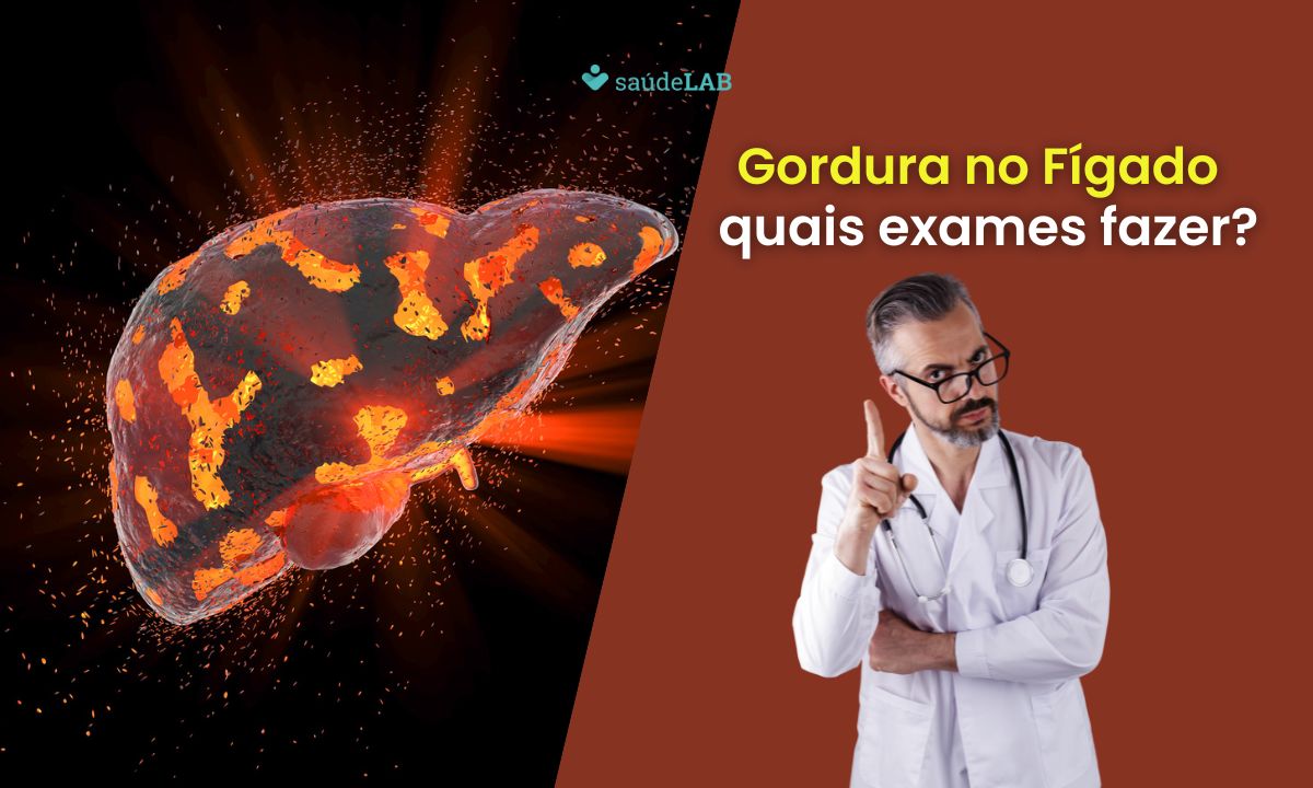 Qual exame detecta gordura no fígado? Saiba como é feito o diagnóstico do problema 1 Qual exame detecta gordura no fígado.