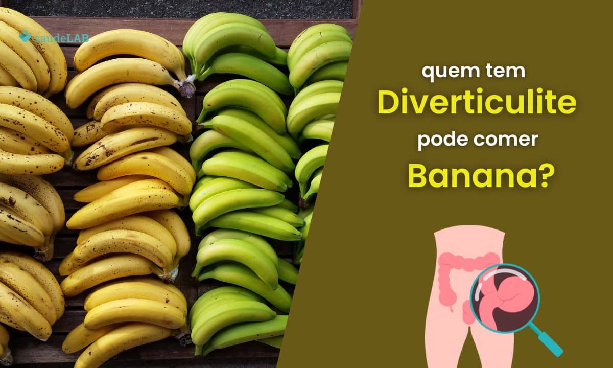 Quem tem diverticulite pode comer banana? Fique por dentro dos detalhes 1 Quem tem diverticulite pode comer banana.