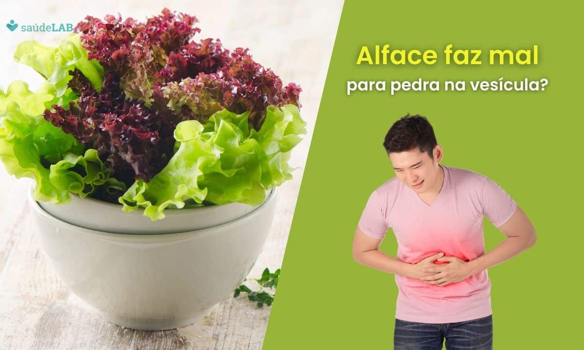 Quem tem pedra na vesícula pode comer alface? Saiba o que pode acontecer 1 Quem tem pedra na vesícula pode comer alface.