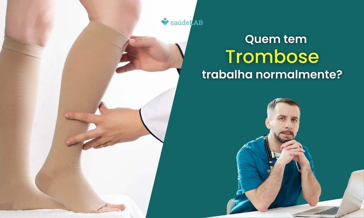 Quem tem trombose pode trabalhar normalmente? Entenda os cuidados essenciais 1 Quem tem trombose trabalha normalmente.