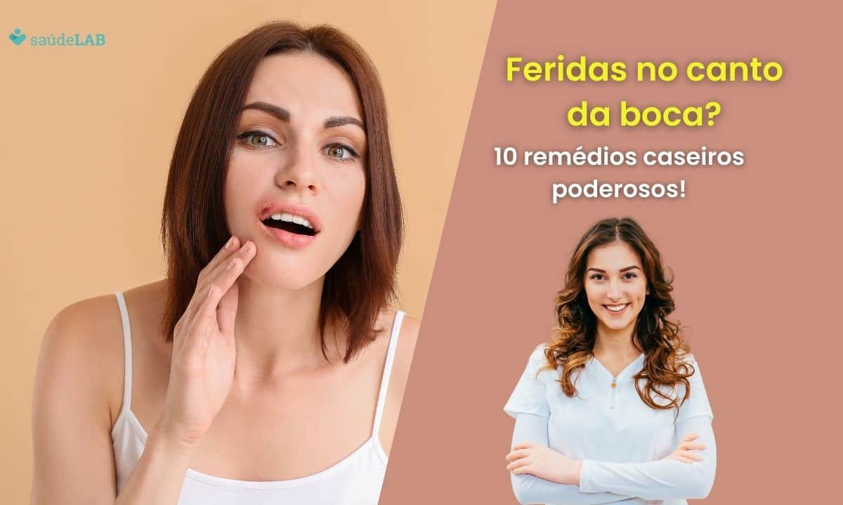 Remédio Caseiro para ferida no canto da boca: 10 receitas para amenizar os sintomas 1 Remédio Caseiro para ferida no canto da boca.