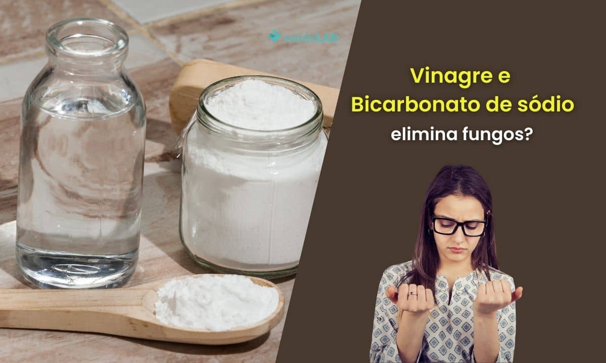 Vinagre e bicarbonato para fungo nas unhas: a misturinha serve? Saiba mais 1 Vinagre e bicarbonato para fungo nas unhas.