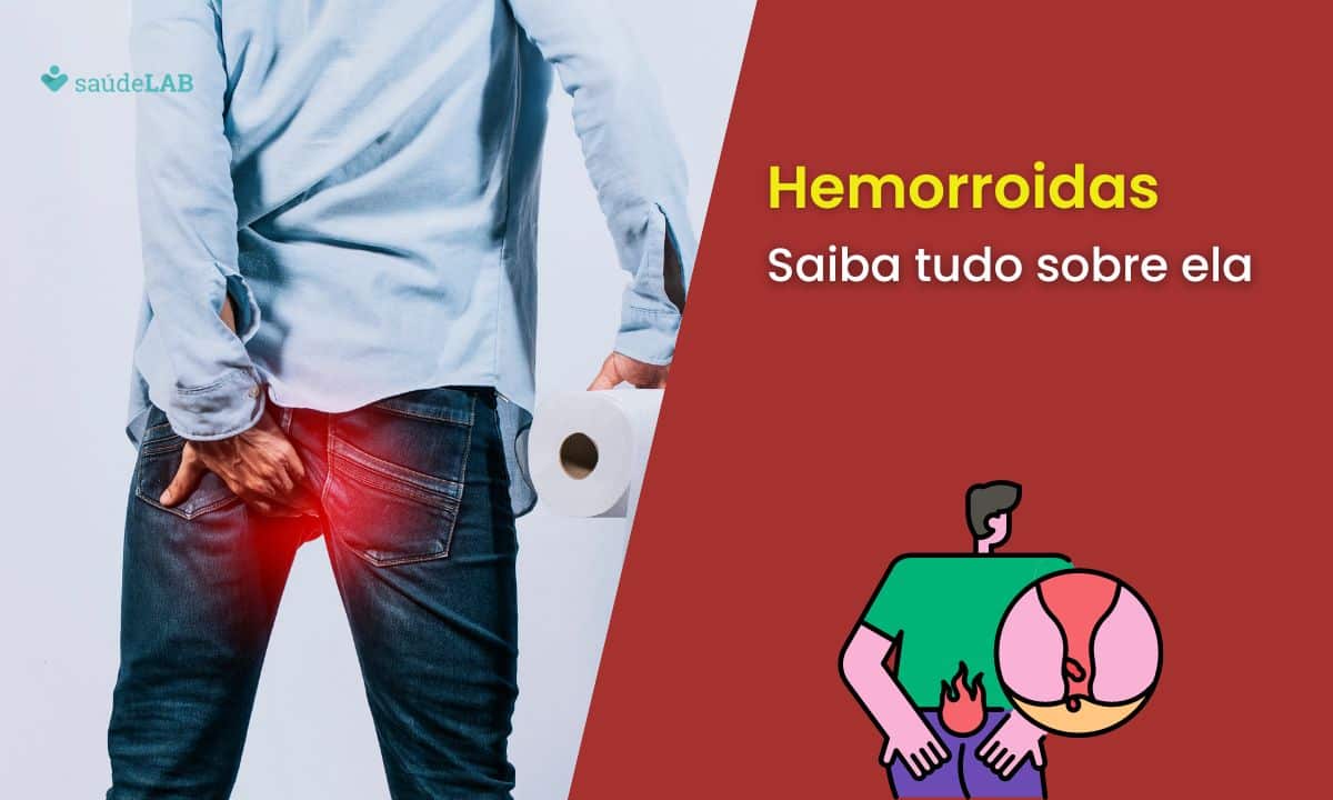 Hemorroidas: o que é, causas, o que piora e o que melhora? Saiba tudo aqui 1 Hemorroidas.