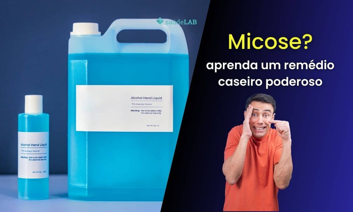 Remédio caseiro para micose com álcool 70: saiba o jeito certo de fazer a como usar 1 Remédio caseiro para micose com álcool 70.