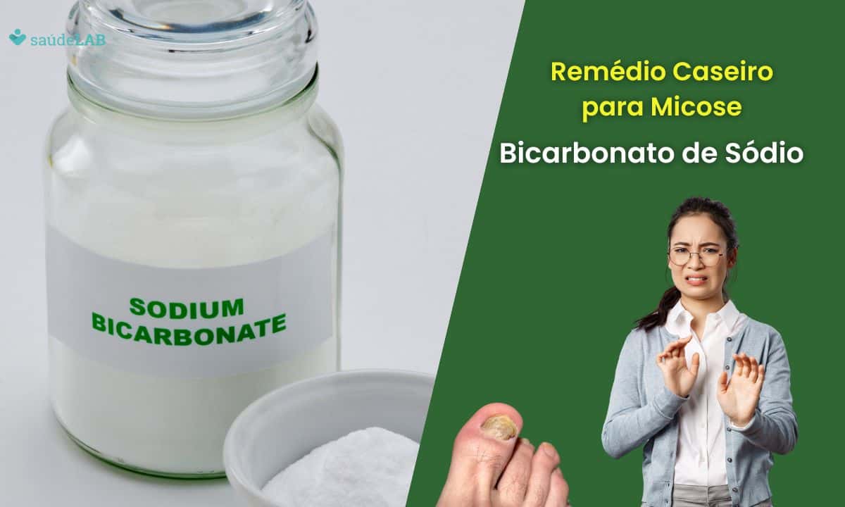 Remédio caseiro para micose de unha com bicarbonato: saiba como fazer corretamente 1 Remédio caseiro para micose de unha com bicarbonato