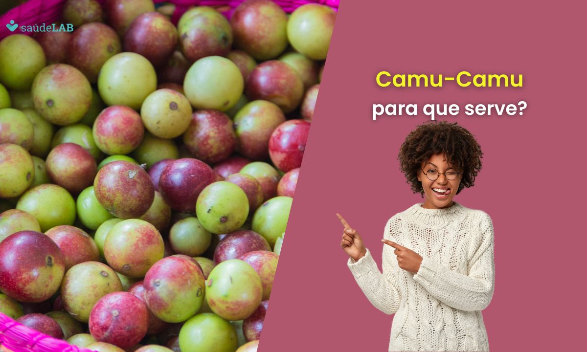 Camu-camu pra que serve? Conheça os benefícios dessa fruta exótica 1 Camu-camu para que serve.
