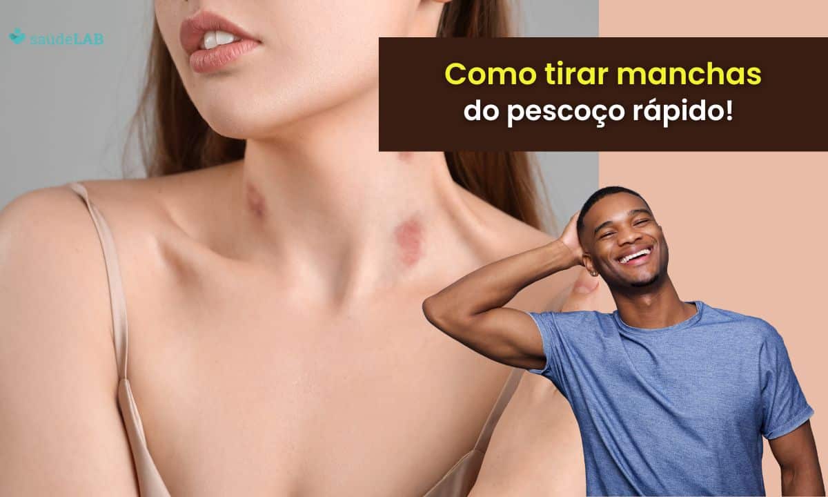 Como tirar mancha do pescoço rápido? Dicas eficientes para eliminas as marcas do "chupão" 1 Como tirar a mancha do pescoço rápido. Foto: Canva PRO
