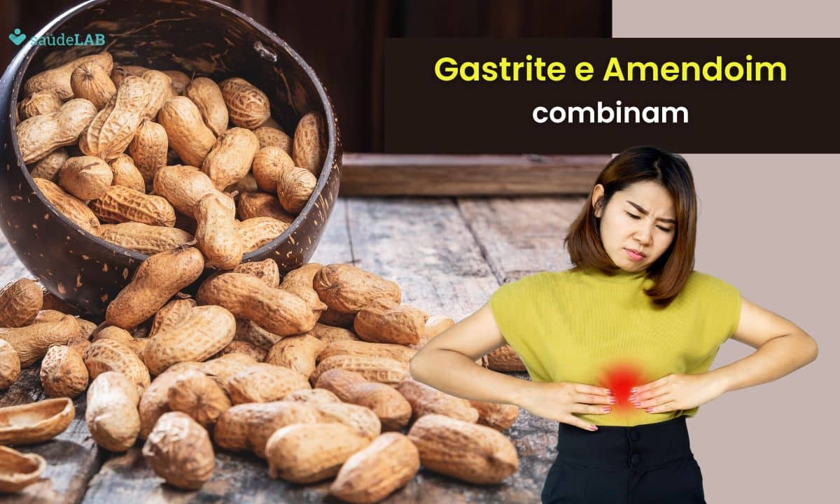 Quem tem gastrite pode comer amendoim? Entenda melhor a questão 1 quem tem gastrite pode comer amendoim.