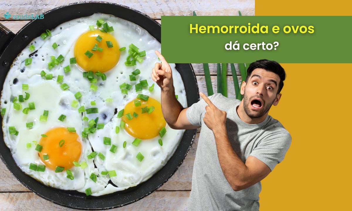 Quem tem hemorroida pode comer ovo? Saiba se o alimento pode prejudicar o quadro 1 Quem tem hemorroida pode comer ovo.
