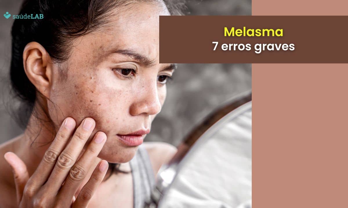 7 erros que pioram o melasma: saiba quais são e evite a todo custo! 1 7 erros que pioram o melasma.